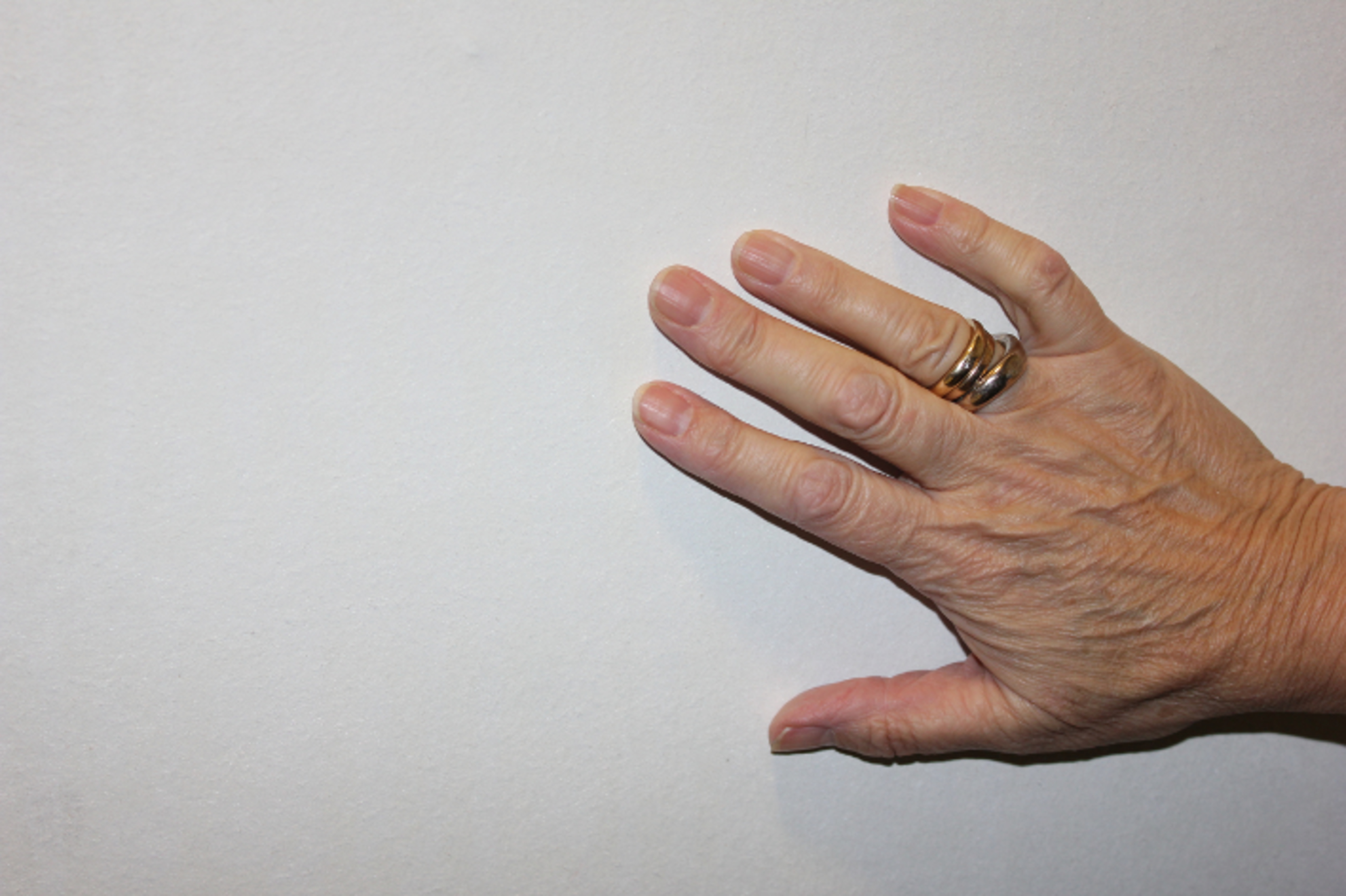 Når det dekorative laget er fjernet, sitter papirbaksiden igjen og gir en fint underlag for ny tapet.