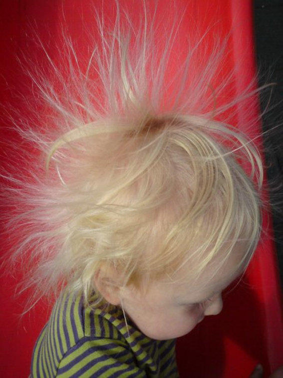 person med statisk hår